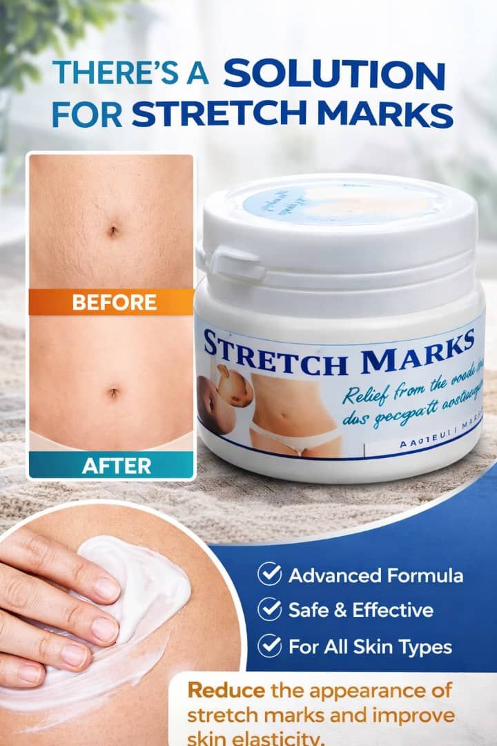 Crème Anti-Vergetures
